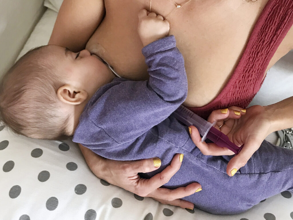 breastfeeding help with the Neotech Bridge (breastfeeding assistance)