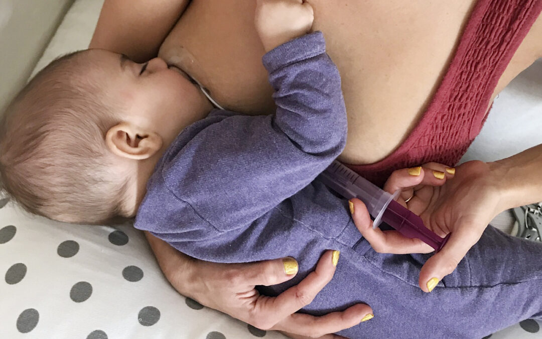 breastfeeding help with the Neotech Bridge