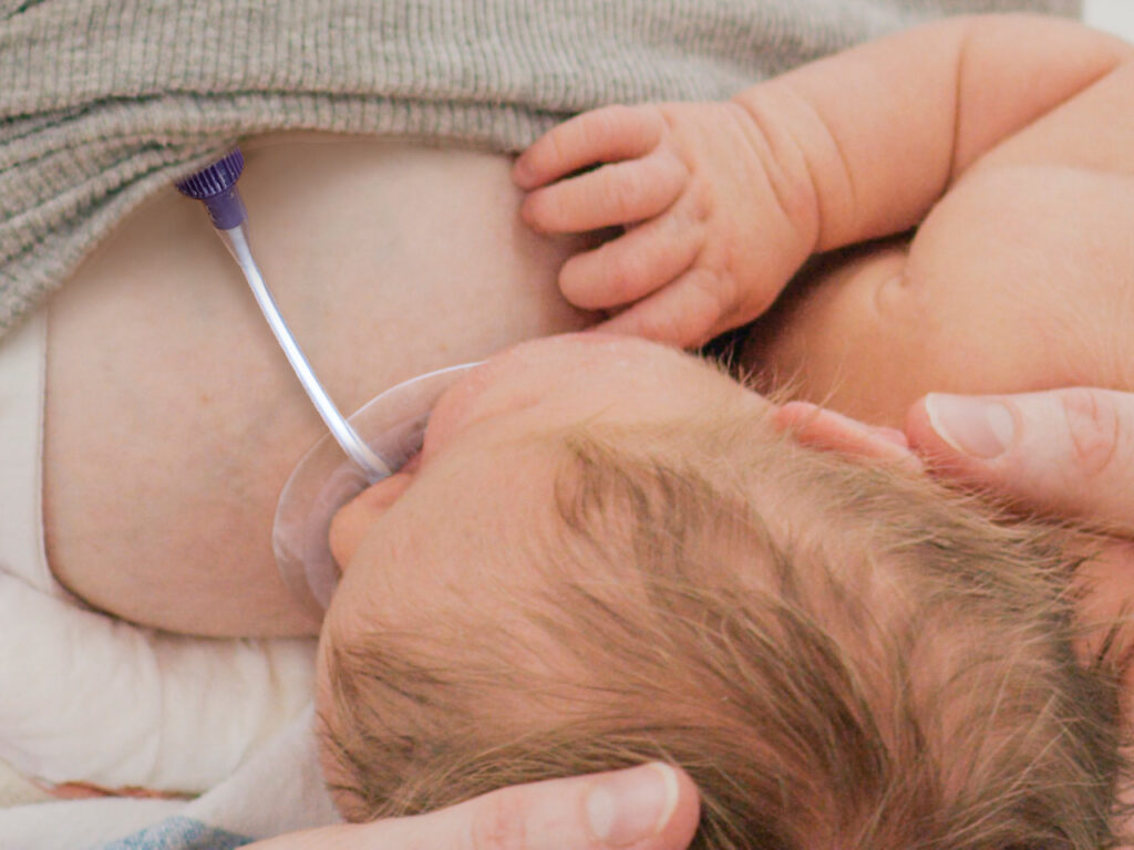 Close up of baby latched onto the Bridge at the breast.